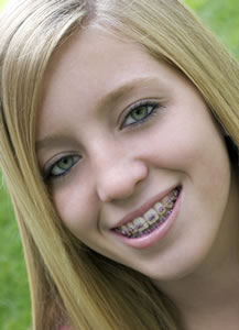 Orthodontic FAQ